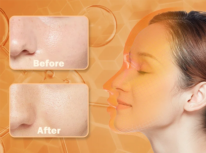 "LED Photon Therapy Infrared Mask – Skin Rejuvenation & Brightening Device ✨"