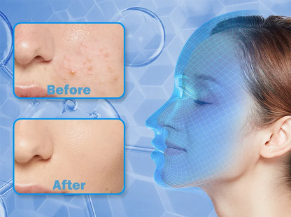 "LED Photon Therapy Infrared Mask – Skin Rejuvenation & Brightening Device ✨"