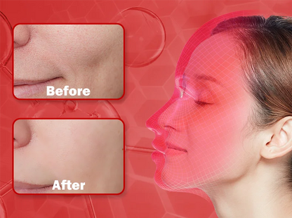 "LED Photon Therapy Infrared Mask – Skin Rejuvenation & Brightening Device ✨"