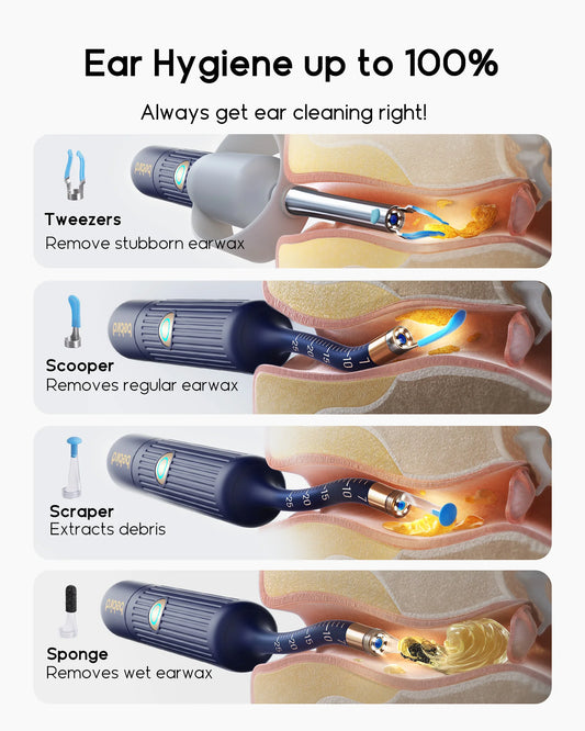 👂 Bebird I35R Visual Ear Cleaner | HD Camera & Wireless Tweezers